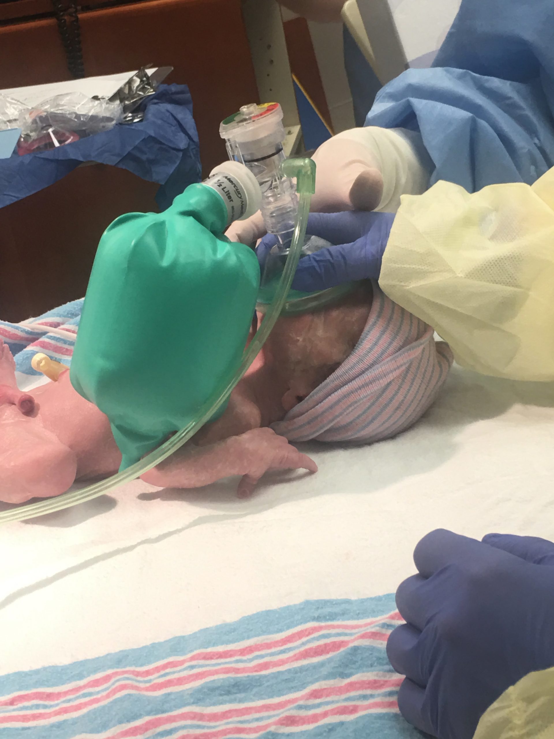 have an IUGR baby? lyonessandcub